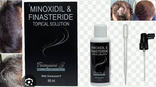 Tricogaine F HAIR REGROWTH TREATMENT MINOXIDIL amp FINASTERIDE TOPICAL SOLUTION [upl. by Onimod]