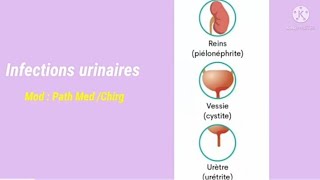 Infections urinaires [upl. by Ttihw526]