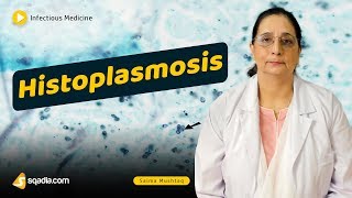 Histoplasmosis  Infectious Diseases Medicine Lecture  Medical School Student  VLearning [upl. by Mallina]