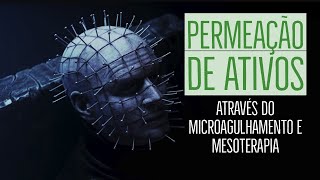 Permeação de Ativos através de Microagulhamento e Mesoterapia [upl. by Sheena]