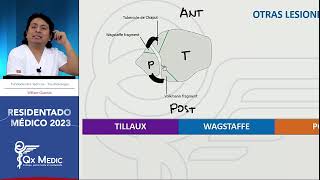 Traumatología  19 Lesiones de tobillo [upl. by Ardeahp]