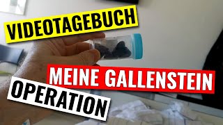 Videotagebuch zur Operation meiner Gallensteine [upl. by Tallia]