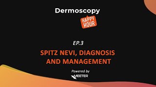 Dermoscopy Happy Hour  SEASON 2 EPISODE 3 quotSPITZ NEVI DIAGNOSIS AND MANAGEMENTquot [upl. by Dnalyag]