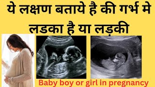 Gender predictionBaby boy symptoms गर्भ मे लडका होने के लक्षण [upl. by Gallagher93]