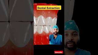 Animated Dental Extraction Procedure yt shorts ytvideodentist toothremoval extractionytshorts [upl. by Wall510]