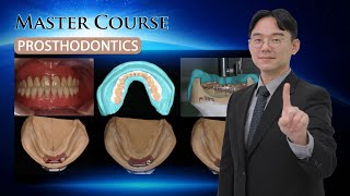 Master Course  PROSTHODONTICS Occlusal scheme of implant prosthesis [upl. by Hollington]