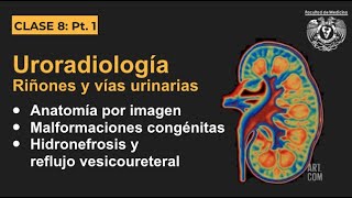 081  Uroradiología  Anatomía por imagen y malformaciones congénitas [upl. by Girish]